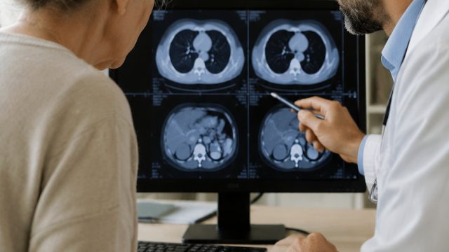 New Study Reveals Link Between Aging and Early Cancer Risk